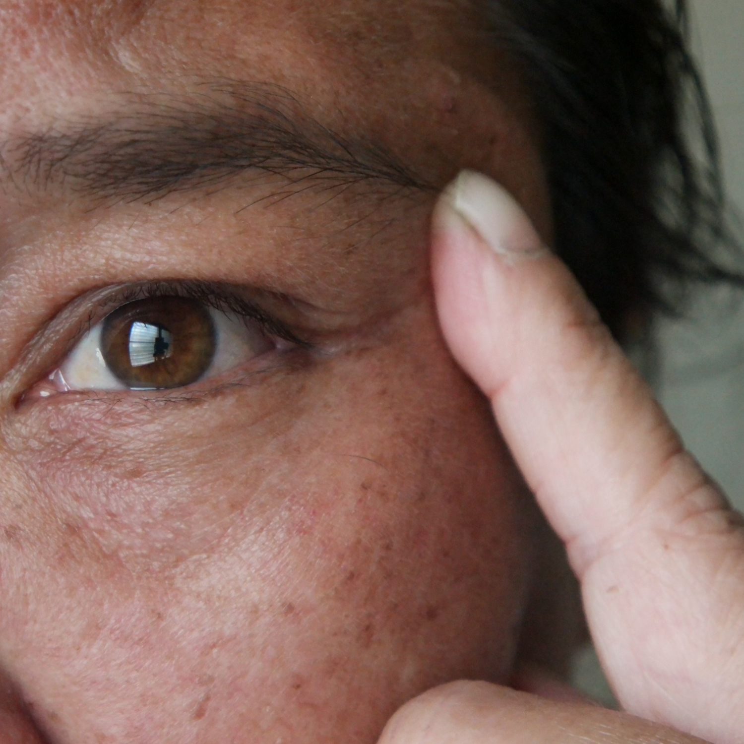 Skincare for pigmentation