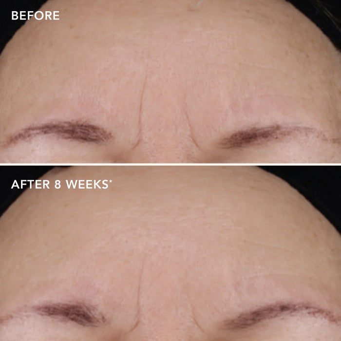 Before and after comparison of a person's skin tone and lines showing improvement over 8 weeks.