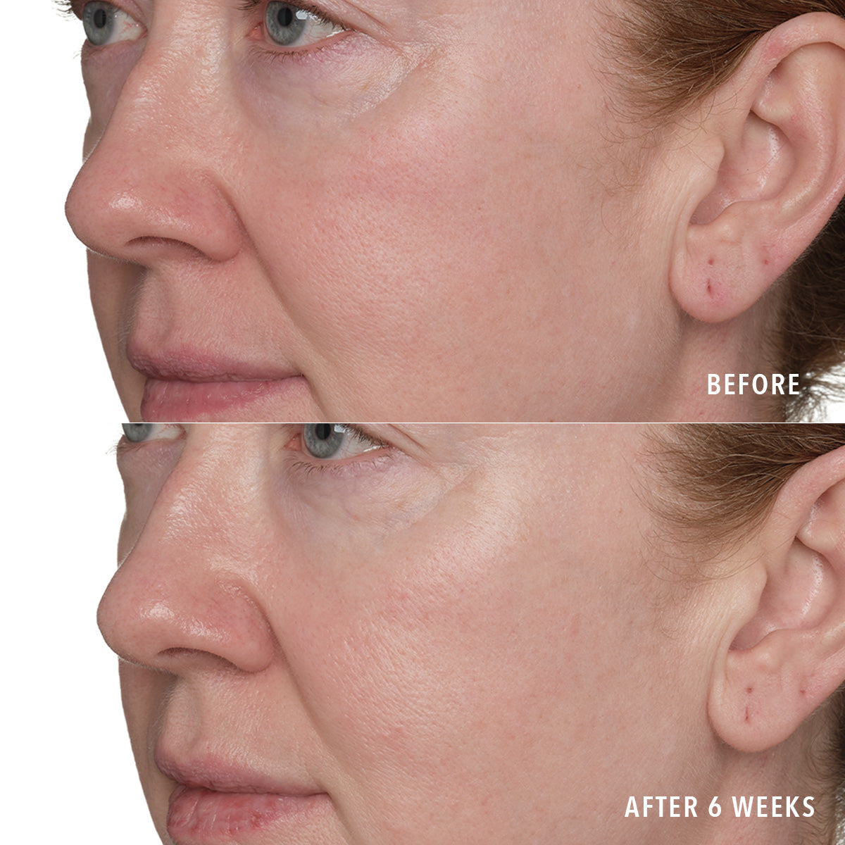 Resurface and Repair Peptide Pads