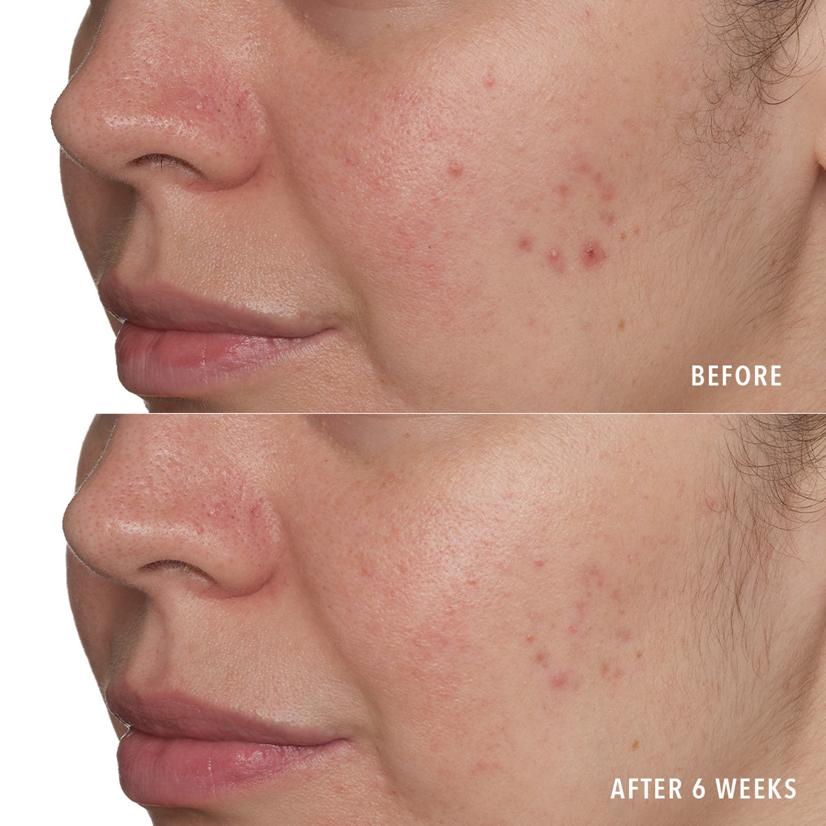 Resurface and Repair Peptide Pads