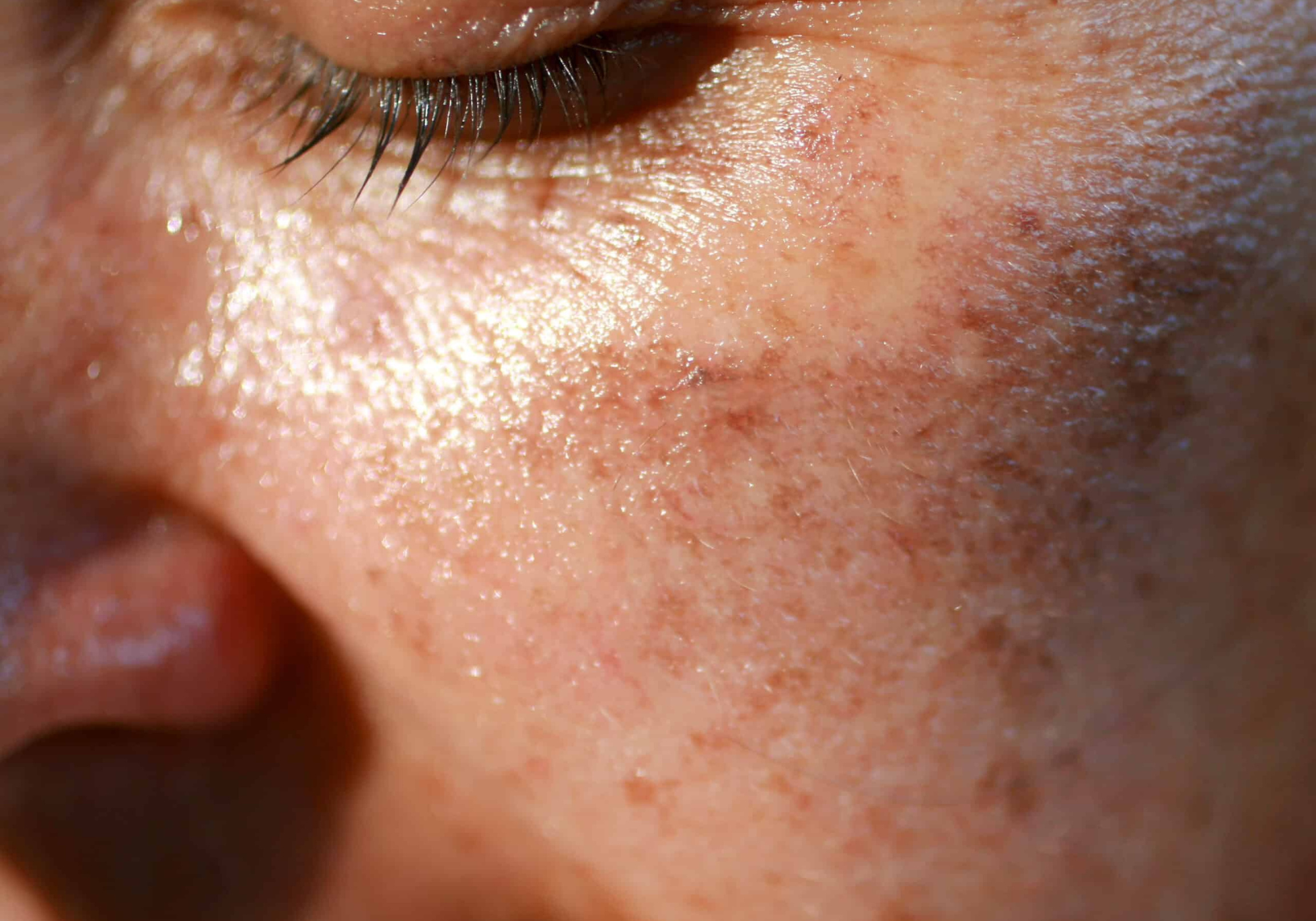 THE TRSA ILLUMINARE PIGMENTATION RENEWAL PACKAGE