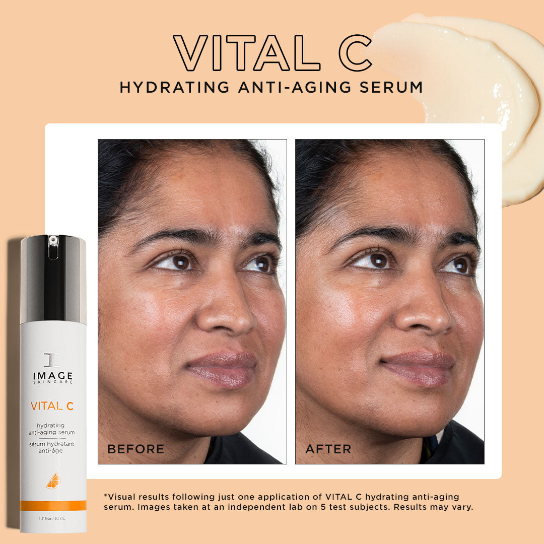 VITAL C hydrating anti-aging serum with before and after results on a woman's face.