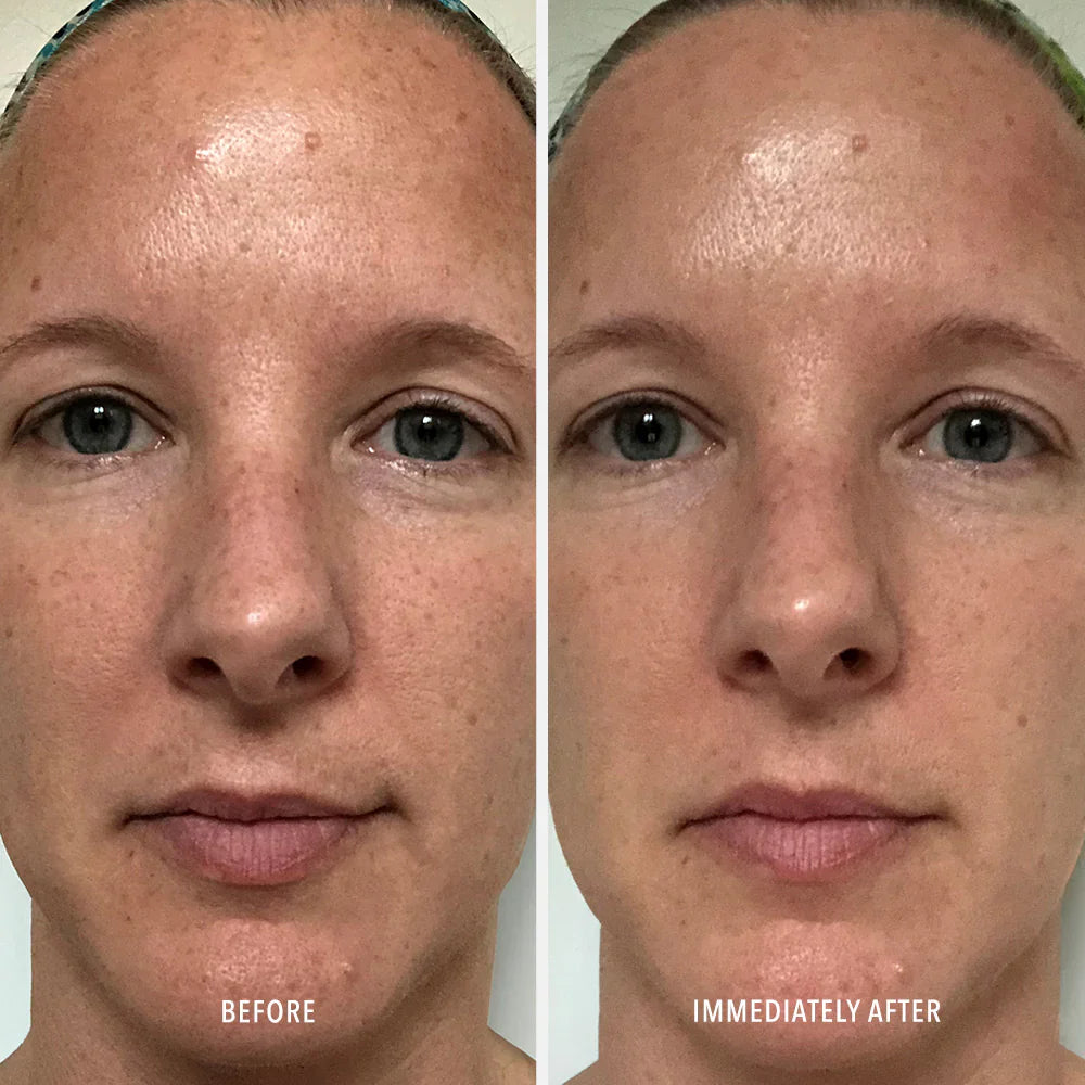 Before and after comparison of a person's face with visible skin texture changes.