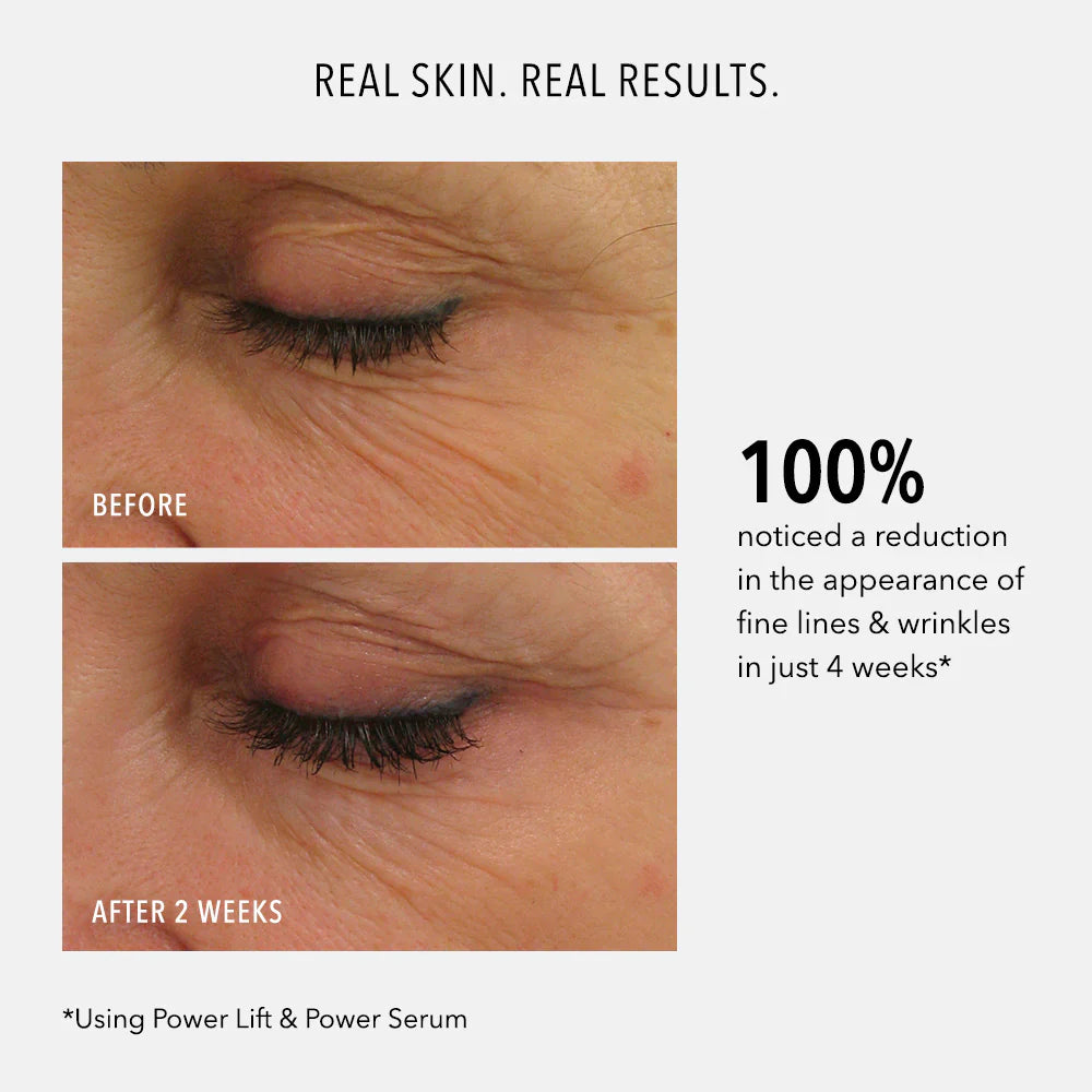 Before and after comparison of eye area with text about skin improvement using Power Lift & Power Serum.