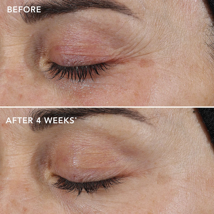 Before and after comparison of eye area skin texture with text indicating 'After 4 Weeks'.
