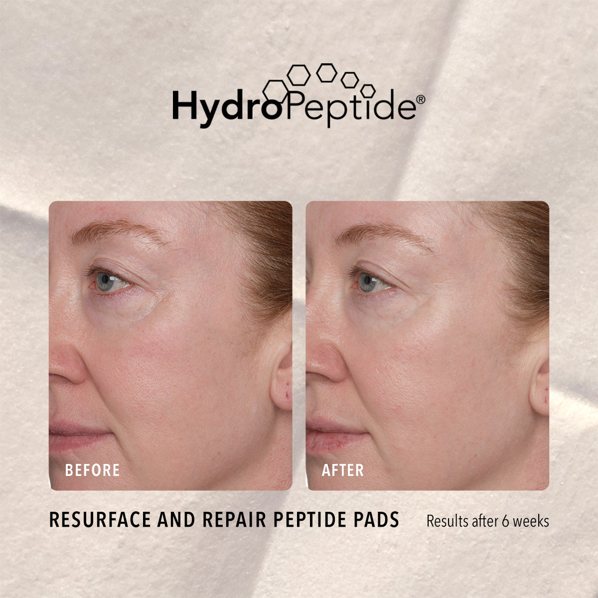 Resurface and Repair Peptide Pads