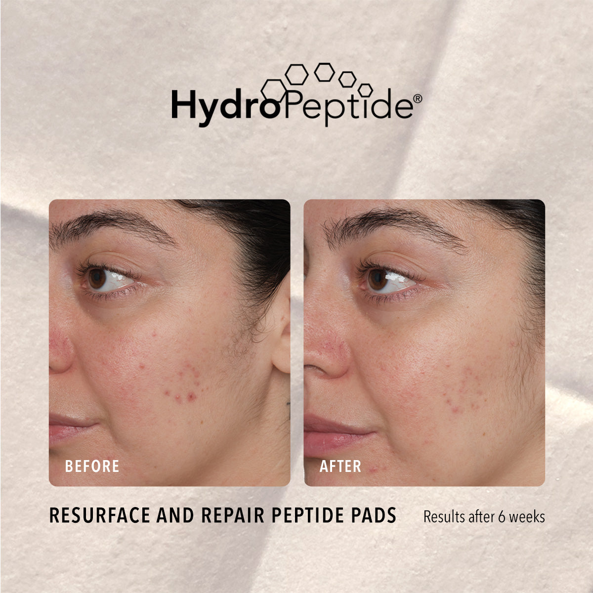 Resurface and Repair Peptide Pads