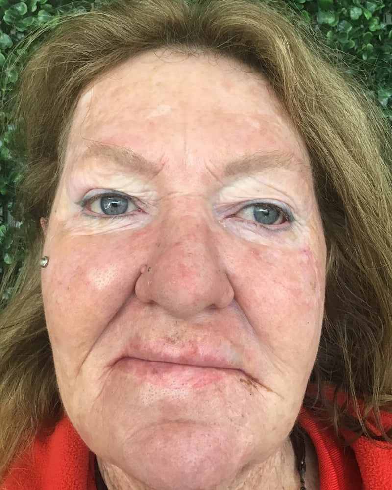 After: calmer, more even skin tone